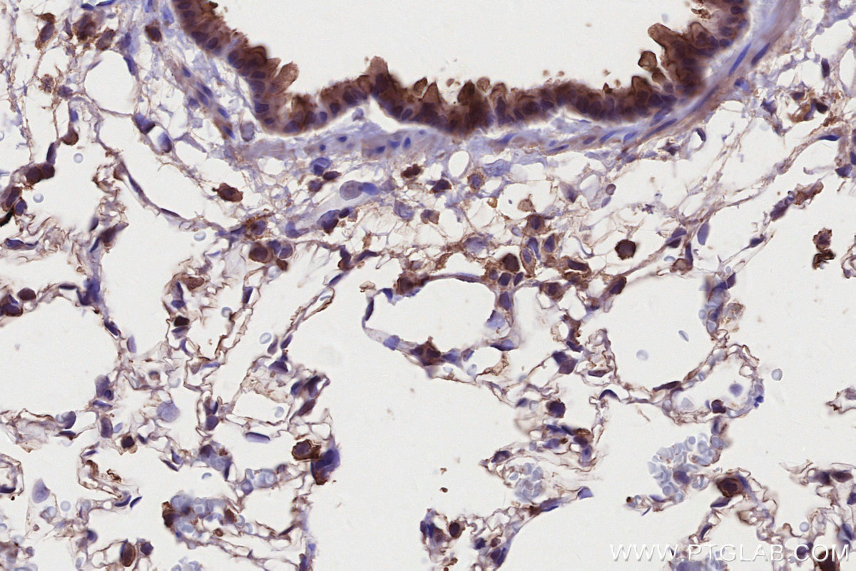 Immunohistochemical analysis of paraffin-embedded rat lung tissue slide using KHC2686 (MLKL IHC Kit).