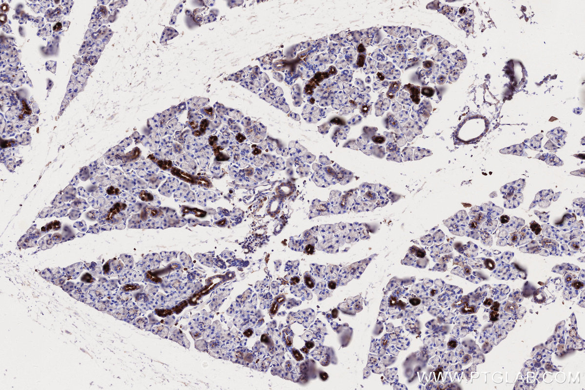 Immunohistochemical analysis of paraffin-embedded mouse salivary gland tissue slide using KHC2686 (MLKL IHC Kit).