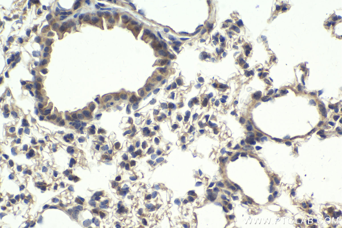 Immunohistochemical analysis of paraffin-embedded mouse lung tissue slide using KHC1981 (MLX IHC Kit).