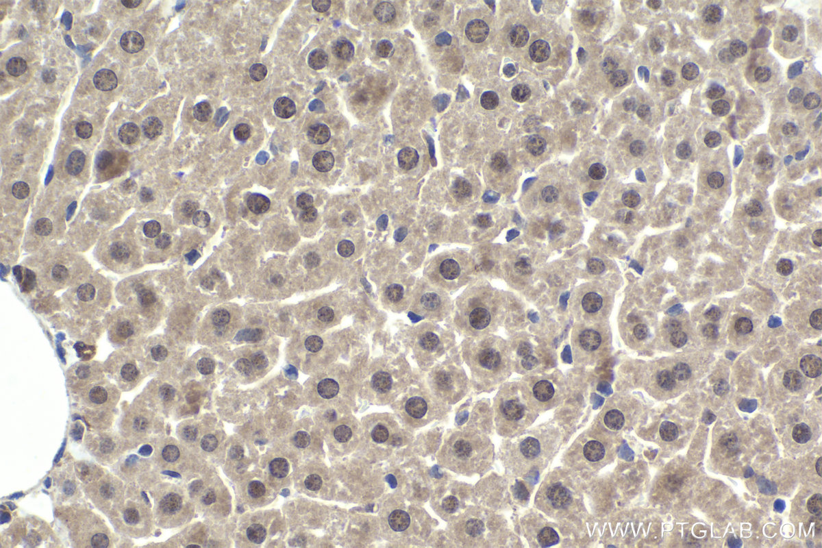 Immunohistochemical analysis of paraffin-embedded mouse liver tissue slide using KHC1981 (MLX IHC Kit).