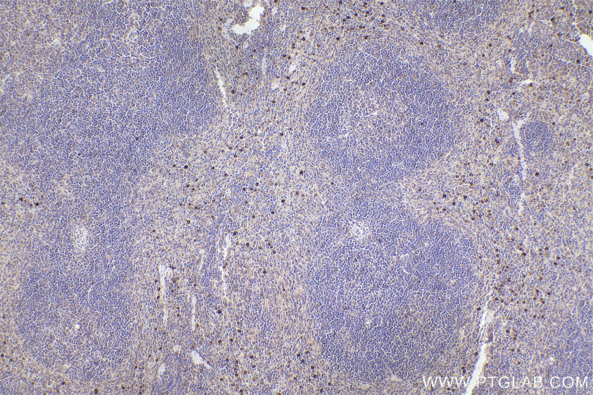 Immunohistochemical analysis of paraffin-embedded mouse spleen tissue slide using KHC2527 (MPEG1 IHC Kit).