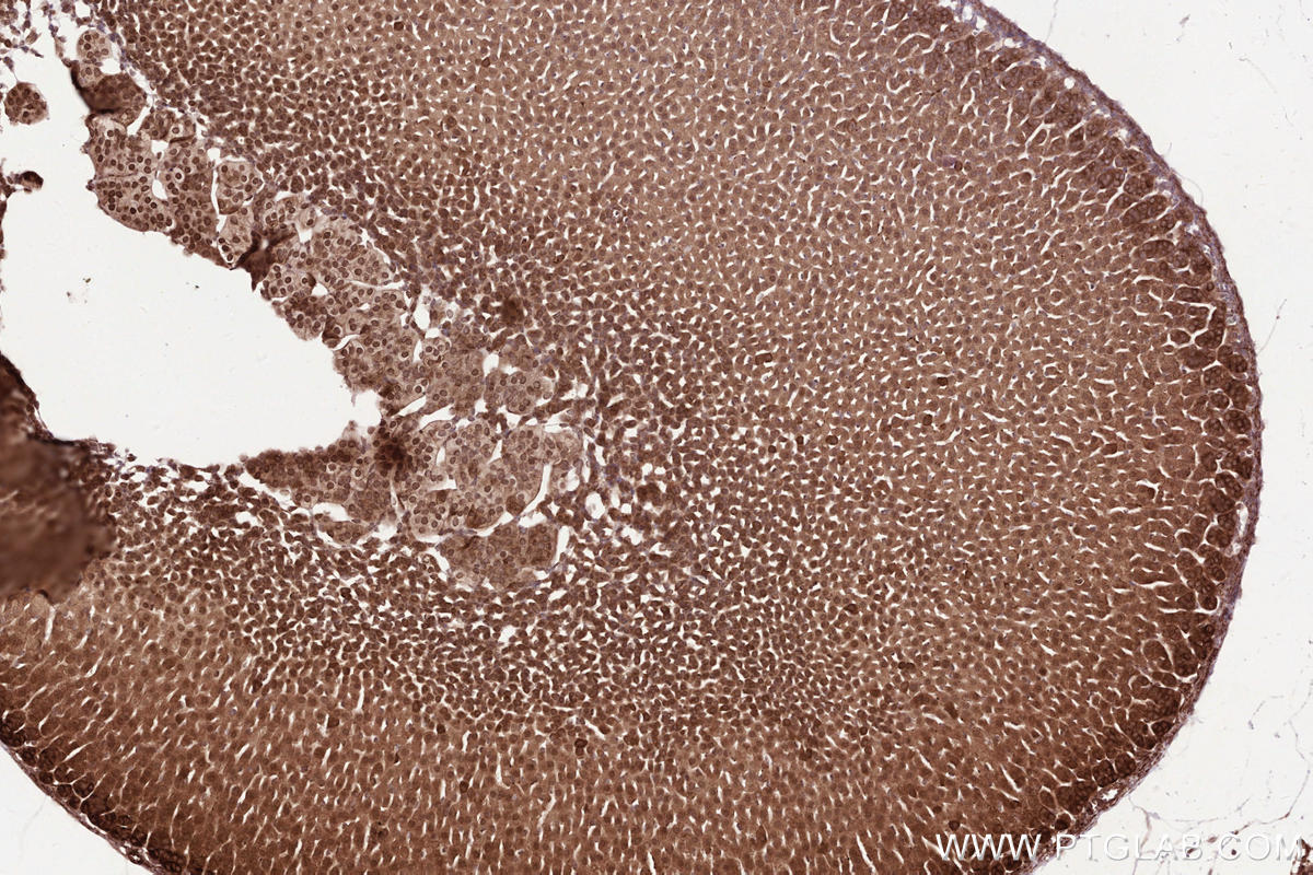 Immunohistochemical analysis of paraffin-embedded mouse adrenal gland tissue slide using KHC2527 (MPEG1 IHC Kit).