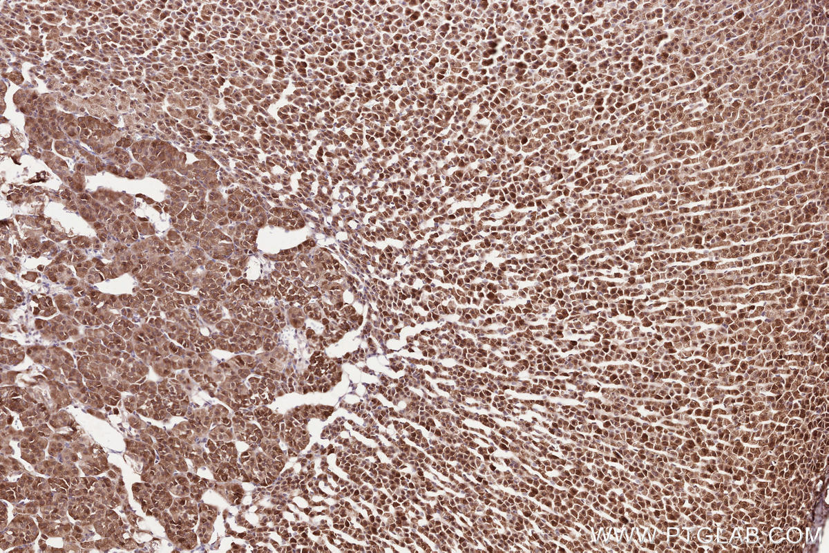 Immunohistochemical analysis of paraffin-embedded rat adrenal gland tissue slide using KHC2527 (MPEG1 IHC Kit).