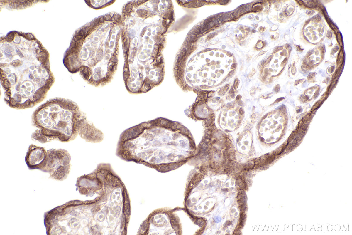 Immunohistochemical analysis of paraffin-embedded human placenta tissue slide using KHC2551 (MPP7 IHC Kit).