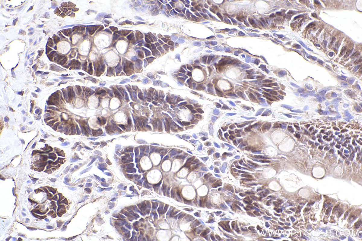 Immunohistochemical analysis of paraffin-embedded rat small intestine tissue slide using KHC2551 (MPP7 IHC Kit).