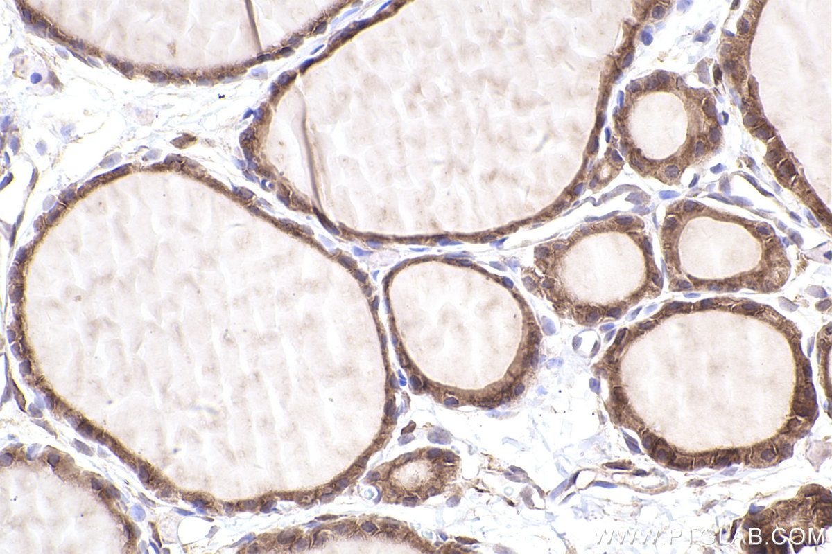 Immunohistochemical analysis of paraffin-embedded rat thyroid gland tissue slide using KHC2551 (MPP7 IHC Kit).