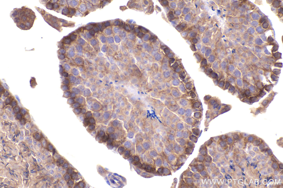 Immunohistochemical analysis of paraffin-embedded mouse testis tissue slide using KHC2260 (MTOR IHC Kit).