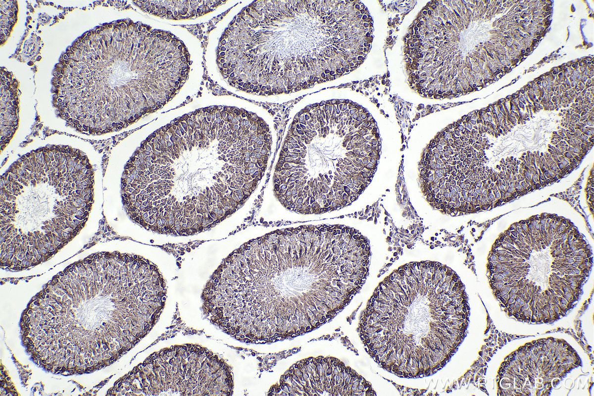 Immunohistochemical analysis of paraffin-embedded rat testis tissue slide using KHC2260 (MTOR IHC Kit).