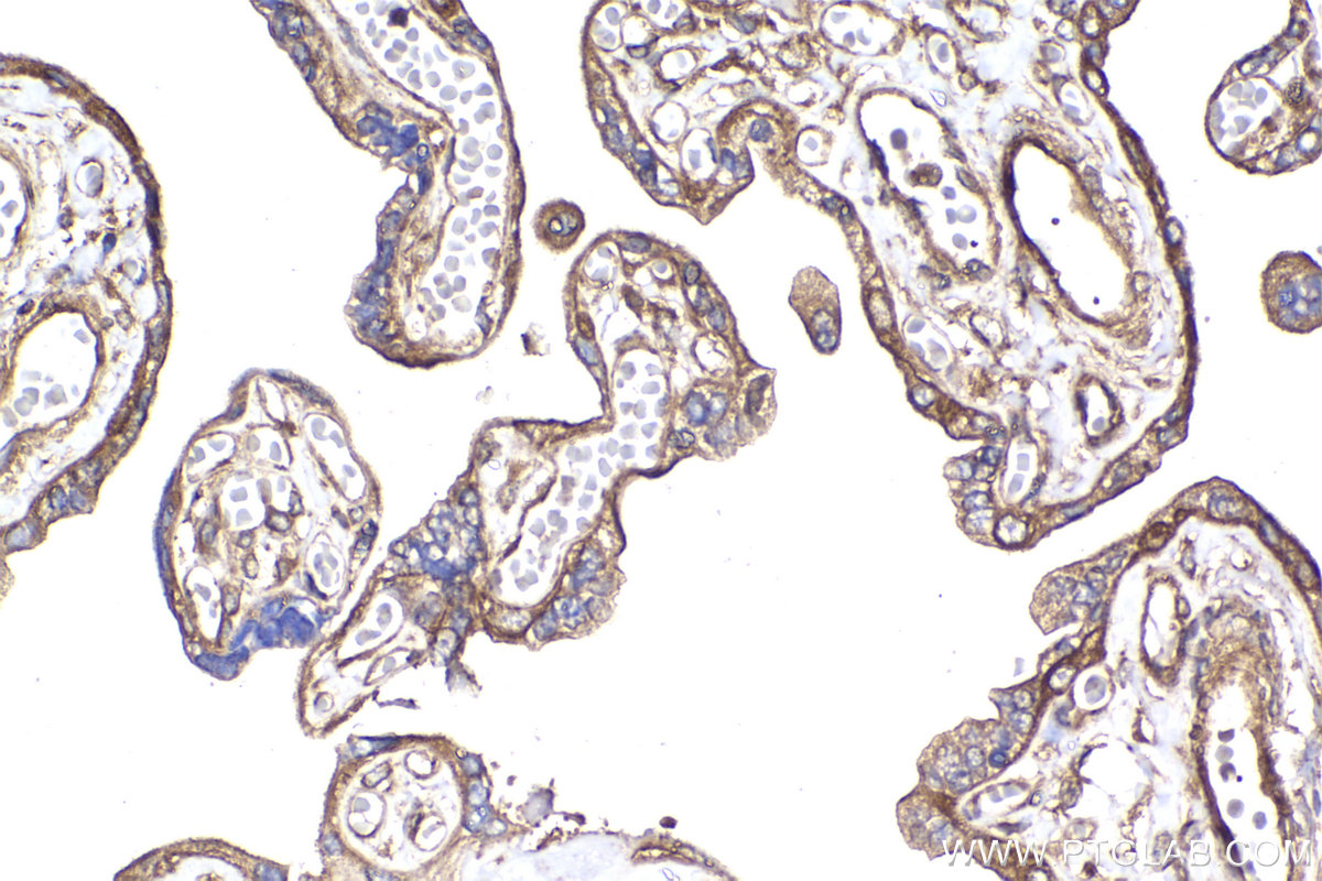 Immunohistochemical analysis of paraffin-embedded human placenta tissue slide using KHC2260 (MTOR IHC Kit).