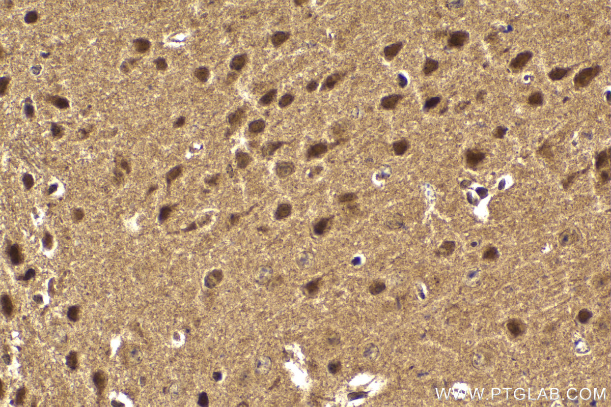 Immunohistochemical analysis of paraffin-embedded mouse brain tissue slide using KHC2116 (MYCBP2 IHC Kit).