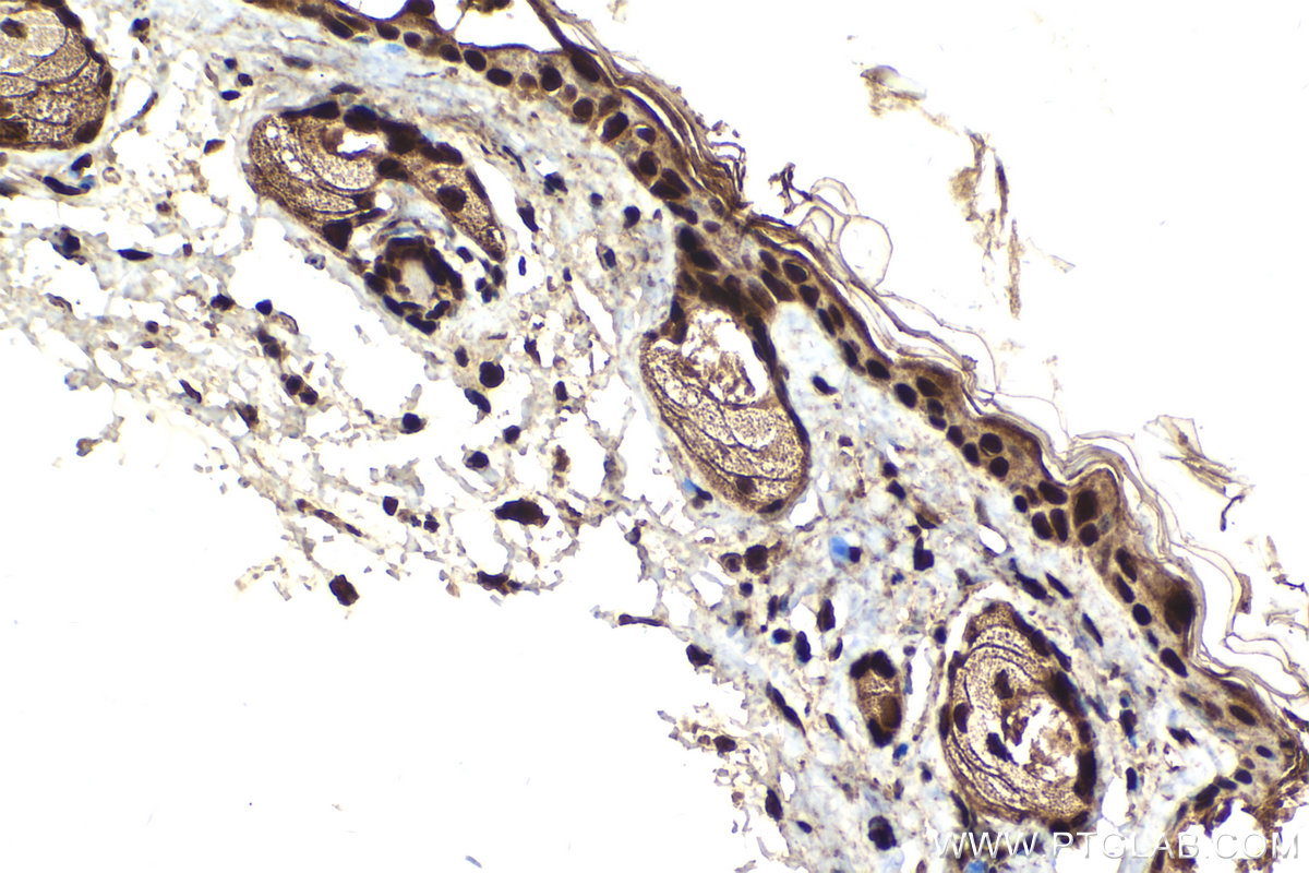 Immunohistochemical analysis of paraffin-embedded mouse skin tissue slide using KHC2116 (MYCBP2 IHC Kit).