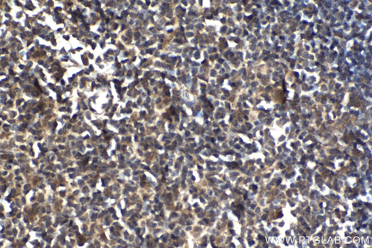 Immunohistochemical analysis of paraffin-embedded rat thymus tissue slide using KHC2116 (MYCBP2 IHC Kit).