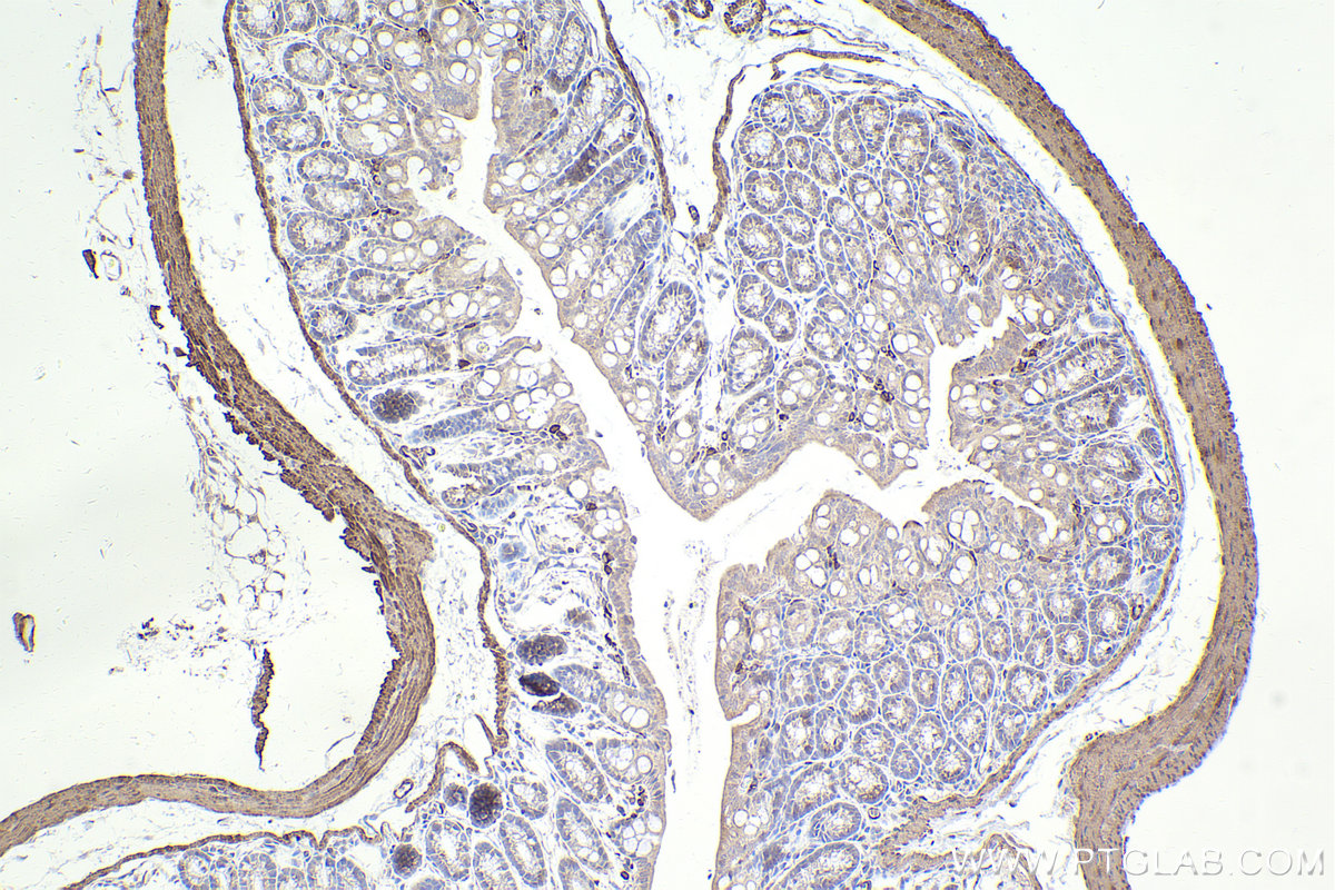 Immunohistochemical analysis of paraffin-embedded mouse colon tissue slide using KHC2496 (MYLK IHC Kit).