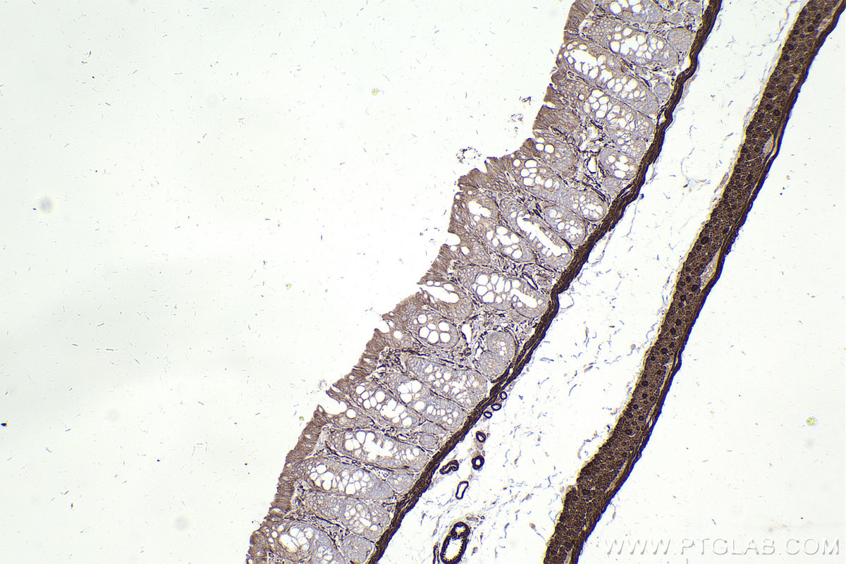 Immunohistochemical analysis of paraffin-embedded rat colon tissue slide using KHC2496 (MYLK IHC Kit).