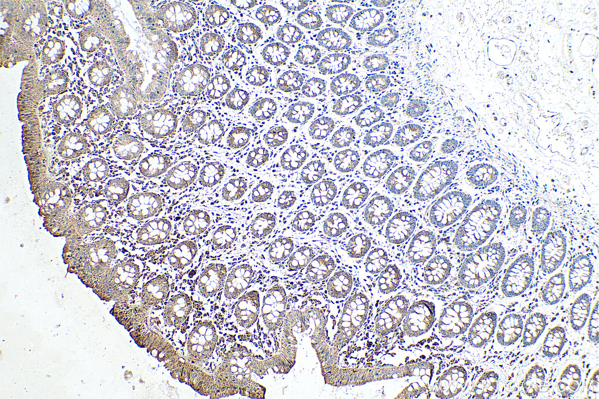 Immunohistochemical analysis of paraffin-embedded human colon tissue slide using KHC0367 (MYO1B IHC Kit).