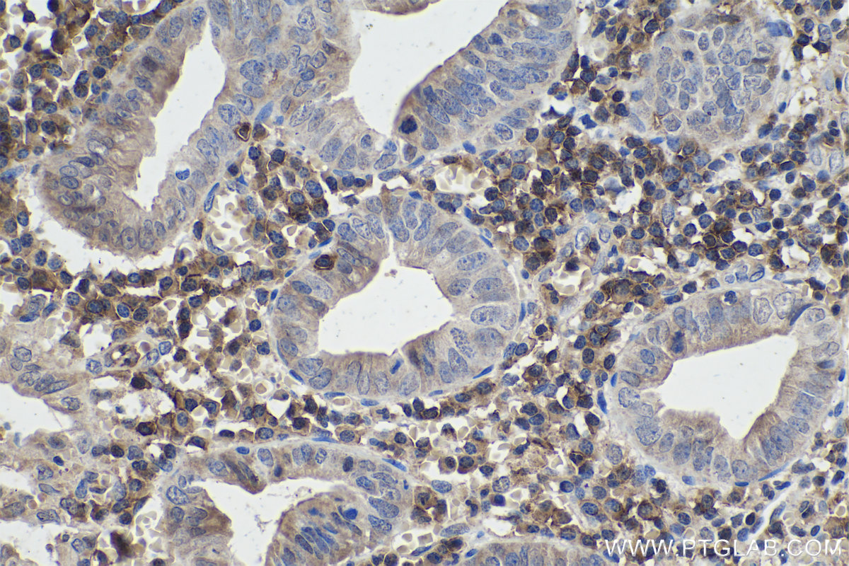 Immunohistochemical analysis of paraffin-embedded human appendicitis tissue slide using KHC0368 (MYO1G IHC Kit).