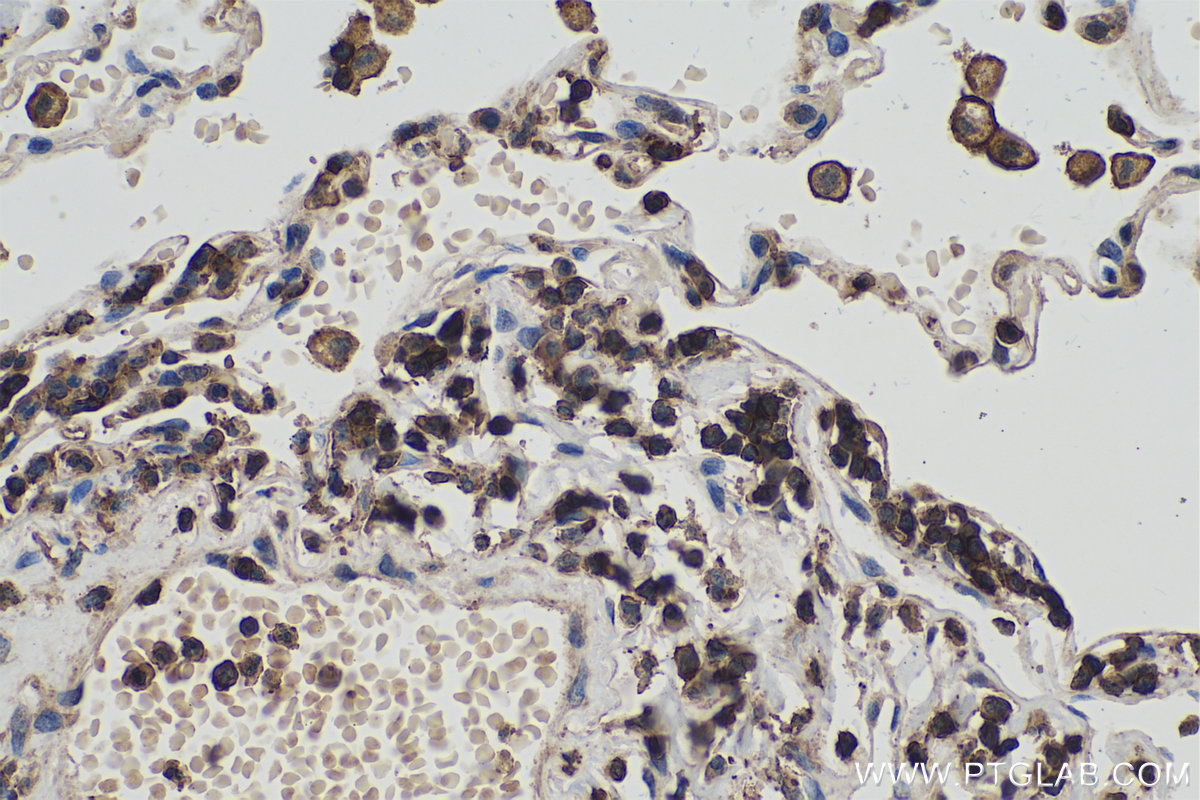 Immunohistochemical analysis of paraffin-embedded human lung tissue slide using KHC0368 (MYO1G IHC Kit).