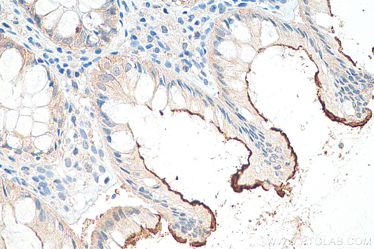 Immunohistochemical analysis of paraffin-embedded human colon tissue slide using KHC0369 (MYO7B IHC Kit).