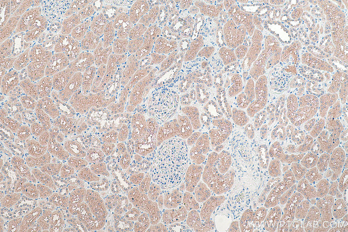 Immunohistochemical analysis of paraffin-embedded human kidney tissue slide using KHC0369 (MYO7B IHC Kit).