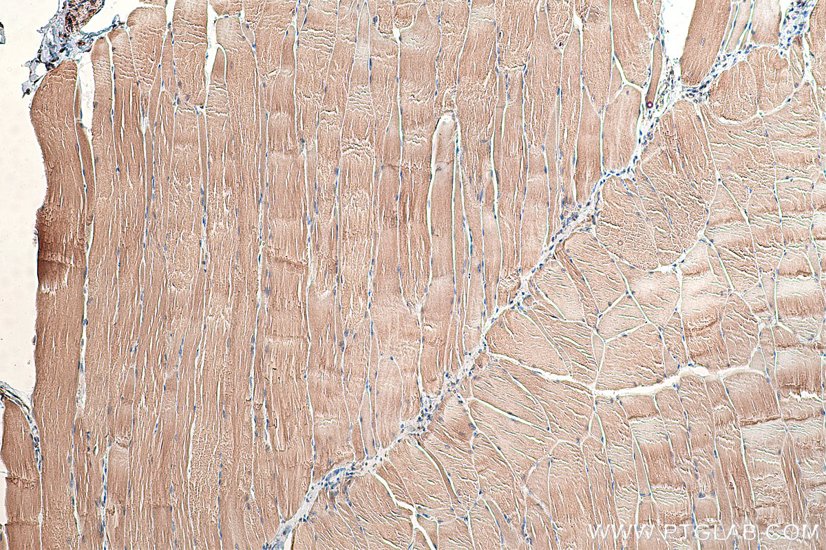 Immunohistochemical analysis of paraffin-embedded rat skeletal muscle tissue slide using KHC0370 (MYO9A IHC Kit).