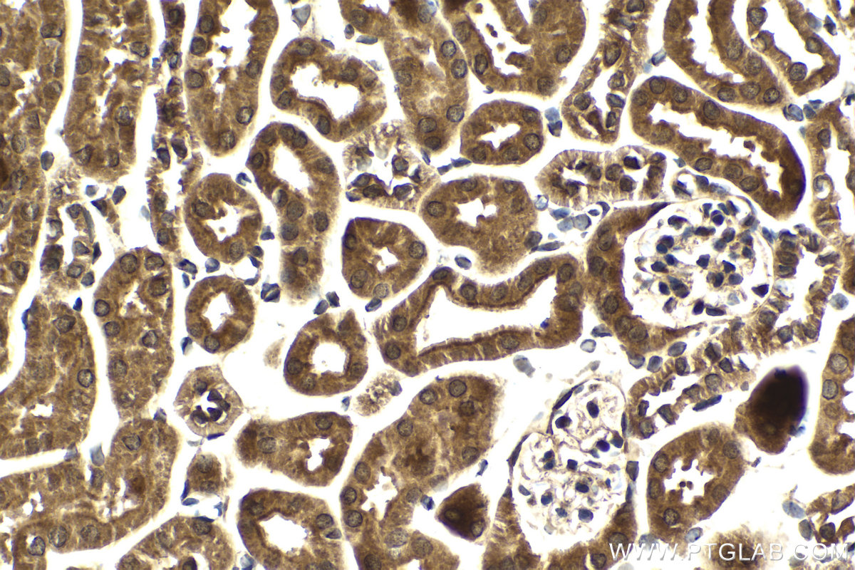 Immunohistochemical analysis of paraffin-embedded mouse kidney tissue slide using KHC2084 (N6AMT1 IHC Kit).