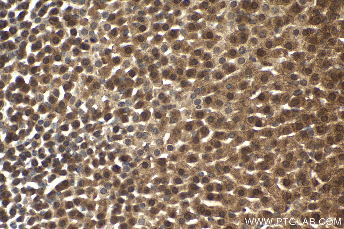 Immunohistochemical analysis of paraffin-embedded mouse adrenal gland tissue slide using KHC2084 (N6AMT1 IHC Kit).