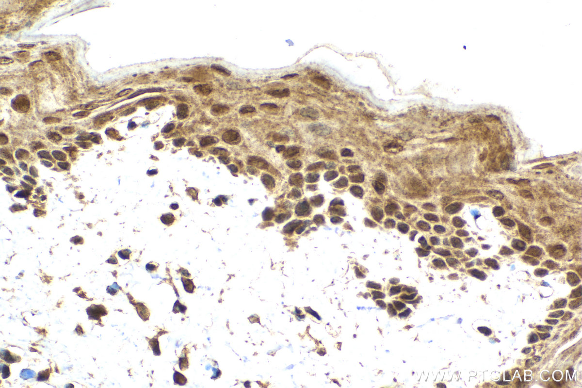 Immunohistochemical analysis of paraffin-embedded mouse tongue tissue slide using KHC2084 (N6AMT1 IHC Kit).