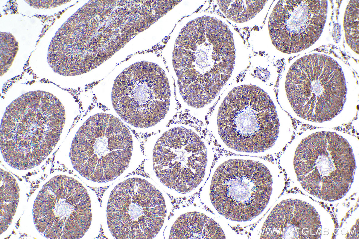 Immunohistochemical analysis of paraffin-embedded rat testis tissue slide using KHC2339 (NAT5 IHC Kit).