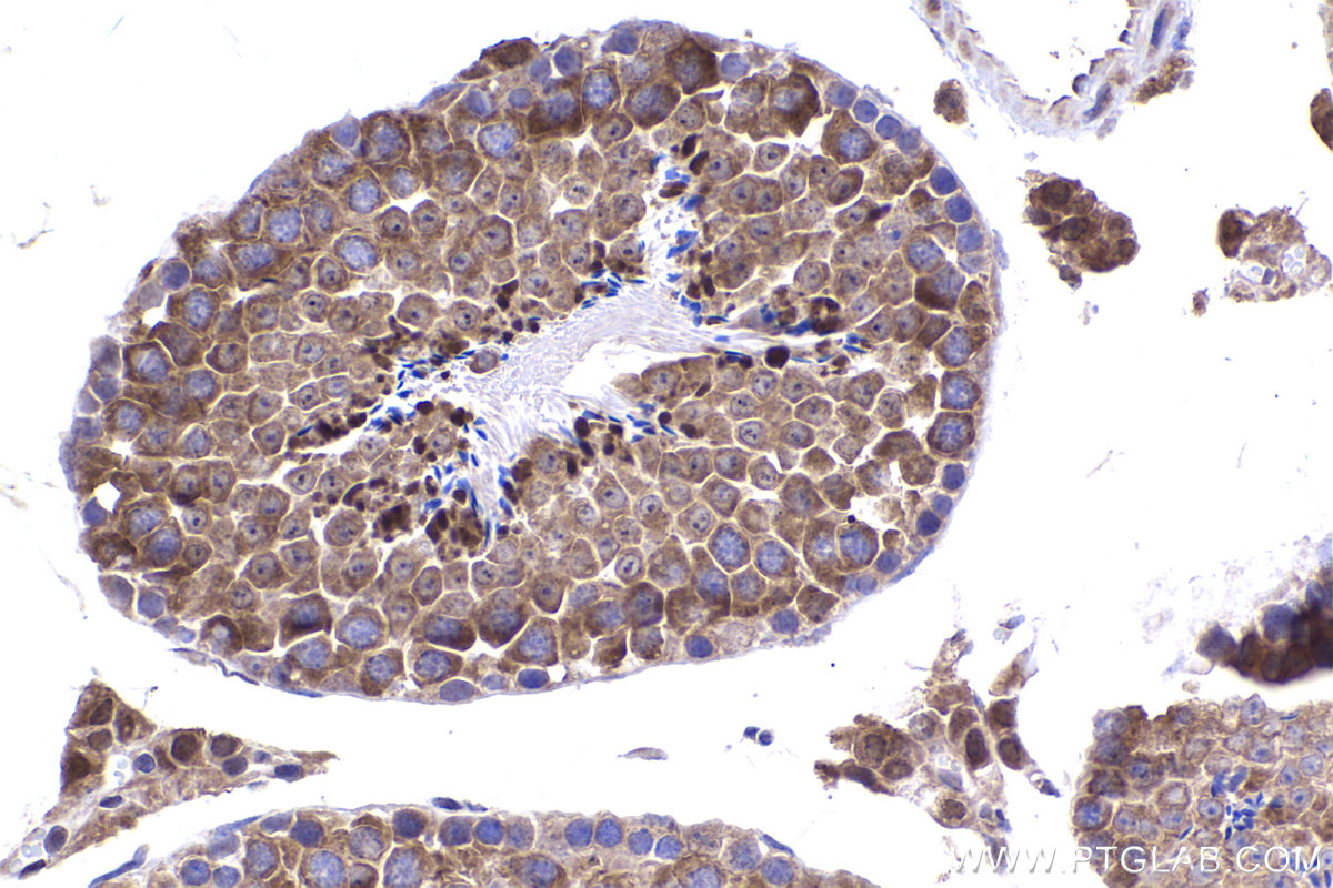 Immunohistochemical analysis of paraffin-embedded mouse testis tissue slide using KHC2339 (NAT5 IHC Kit).