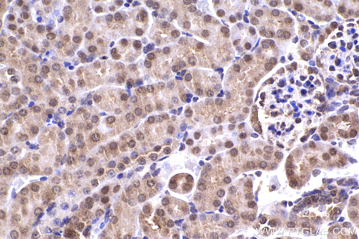 Immunohistochemical analysis of paraffin-embedded mouse kidney tissue slide using KHC2339 (NAT5 IHC Kit).