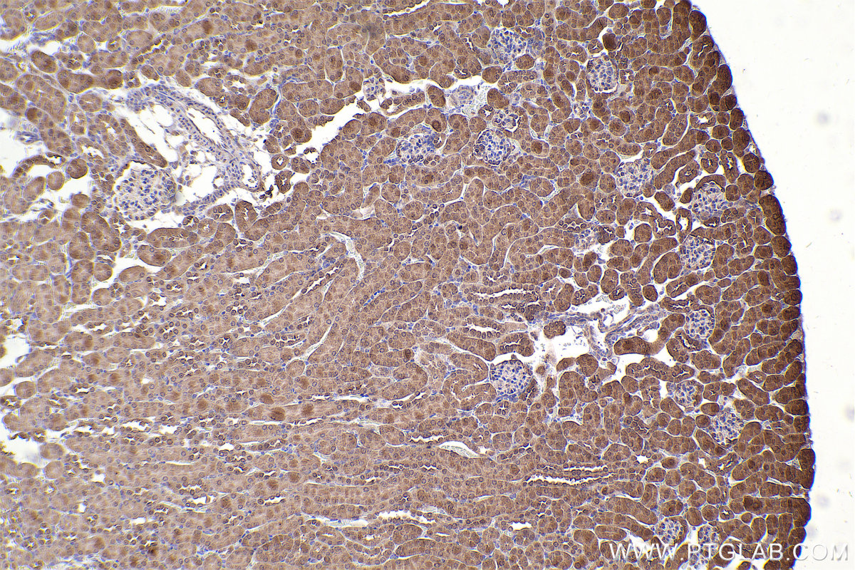 Immunohistochemical analysis of paraffin-embedded mouse kidney tissue slide using KHC2478 (NCAPD2 IHC Kit).