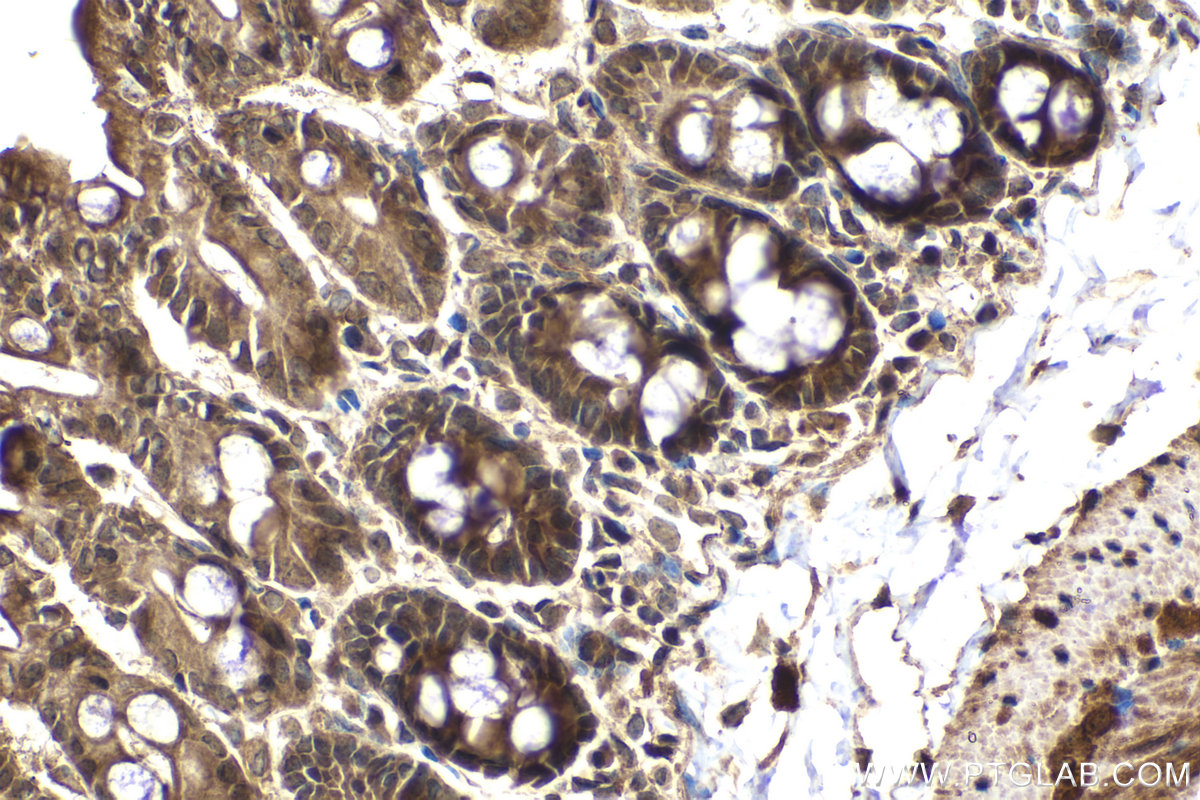 Immunohistochemical analysis of paraffin-embedded mouse small intestine tissue slide using KHC2090 (NCK2 IHC Kit).