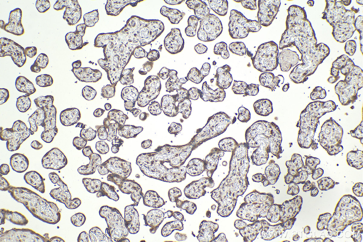 Immunohistochemical analysis of paraffin-embedded human placenta tissue slide using KHC2090 (NCK2 IHC Kit).