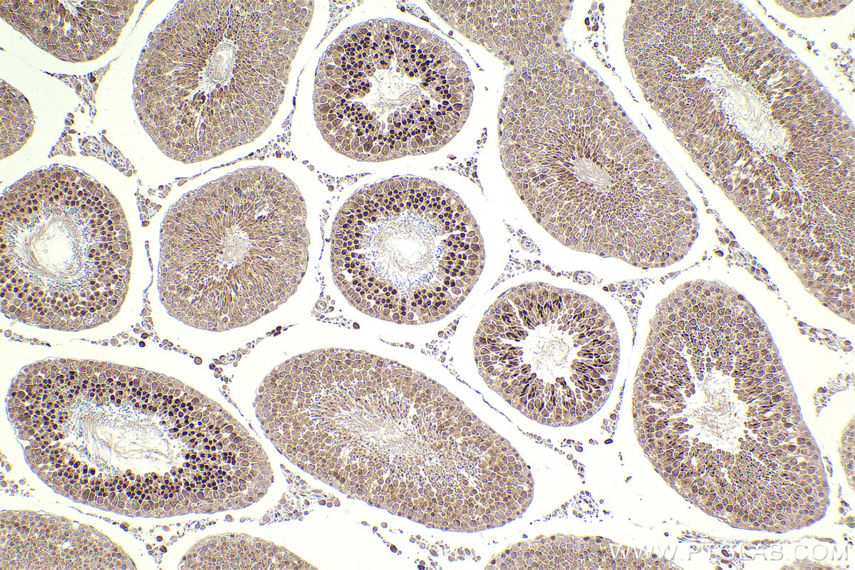 Immunohistochemical analysis of paraffin-embedded rat testis tissue slide using KHC2307 (NEK2 IHC Kit).