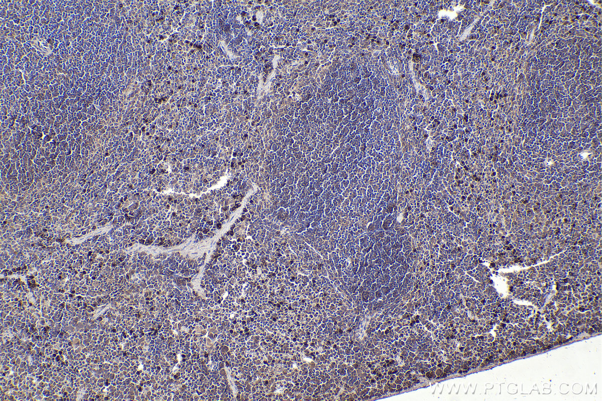 Immunohistochemical analysis of paraffin-embedded mouse spleen tissue slide using KHC2200 (NCF2 IHC Kit).