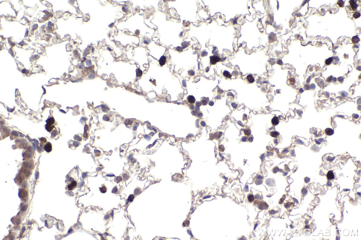 Immunohistochemical analysis of paraffin-embedded mouse lung tissue slide using KHC2200 (NCF2 IHC Kit).