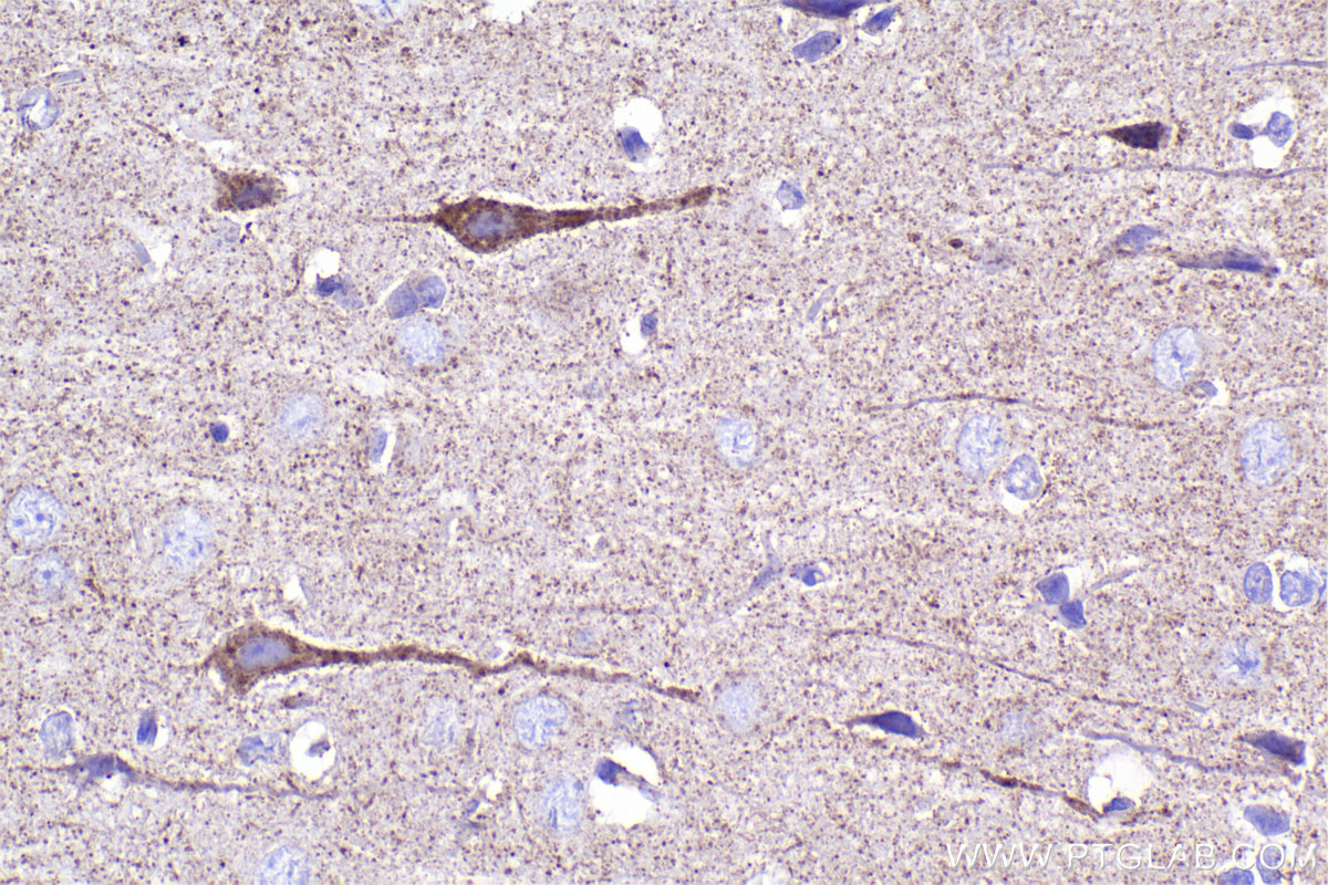 Immunohistochemical analysis of paraffin-embedded rat brain tissue slide using KHC2314 (NUDT6 IHC Kit).