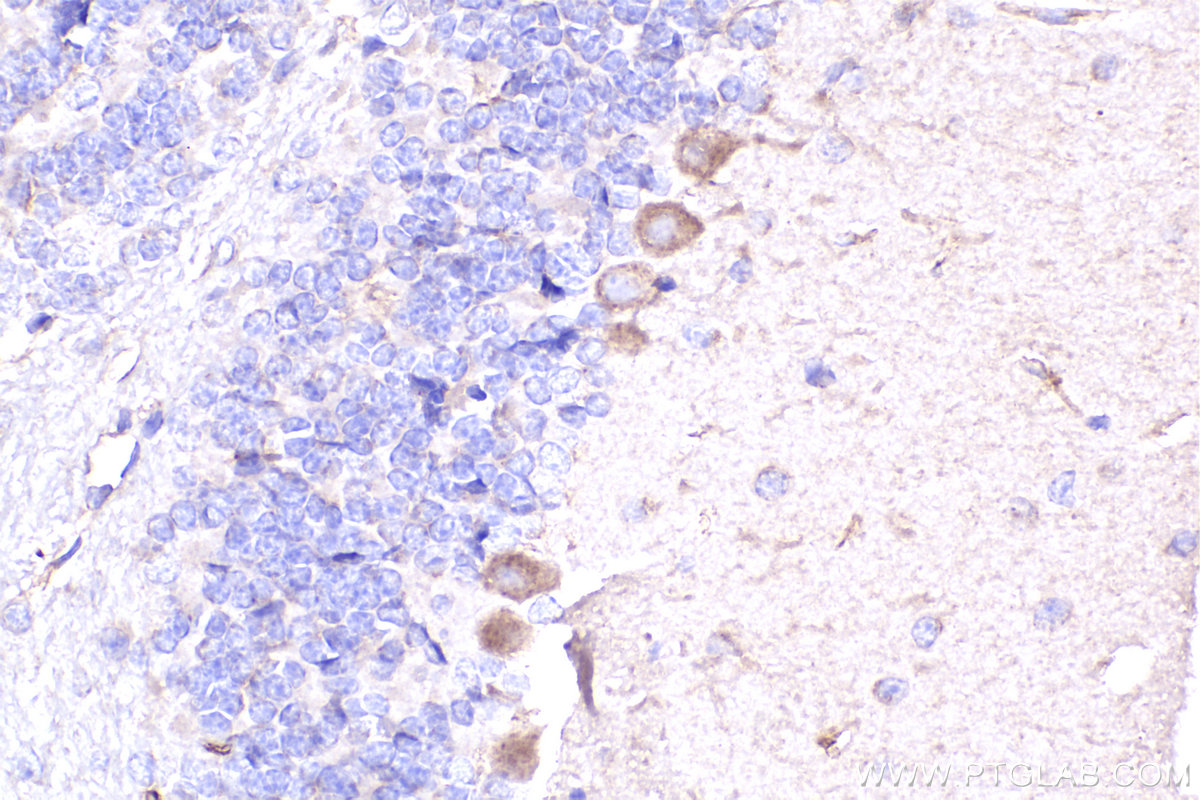 Immunohistochemical analysis of paraffin-embedded mouse cerebellum tissue slide using KHC2283 (Nestin IHC Kit).