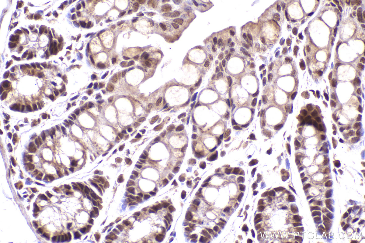 Immunohistochemical analysis of paraffin-embedded mouse colon tissue slide using KHC2471 (NuMA IHC Kit).