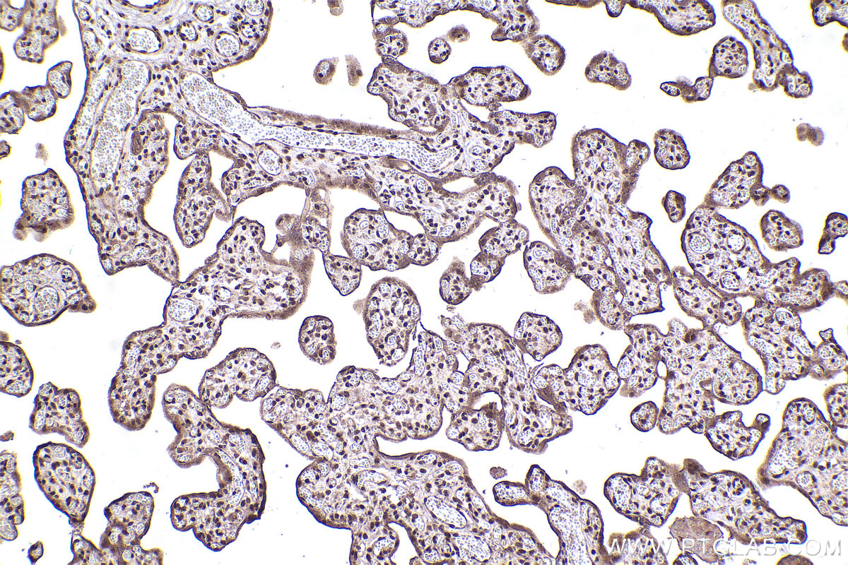 Immunohistochemical analysis of paraffin-embedded human placenta tissue slide using KHC2471 (NuMA IHC Kit).