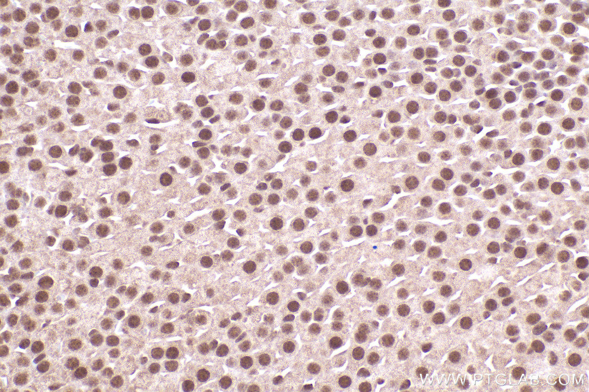 Immunohistochemical analysis of paraffin-embedded mouse adrenal gland tissue slide using KHC2471 (NuMA IHC Kit).