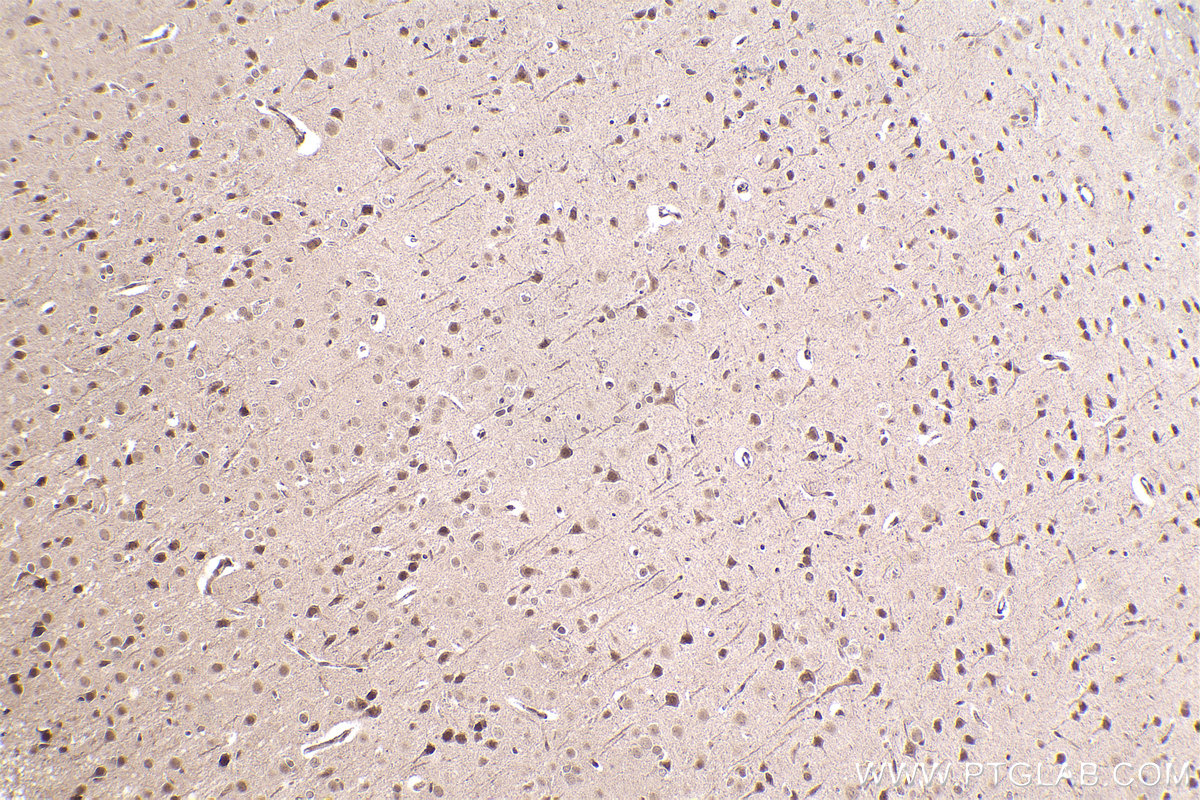 Immunohistochemical analysis of paraffin-embedded rat brain tissue slide using KHC2471 (NuMA IHC Kit).