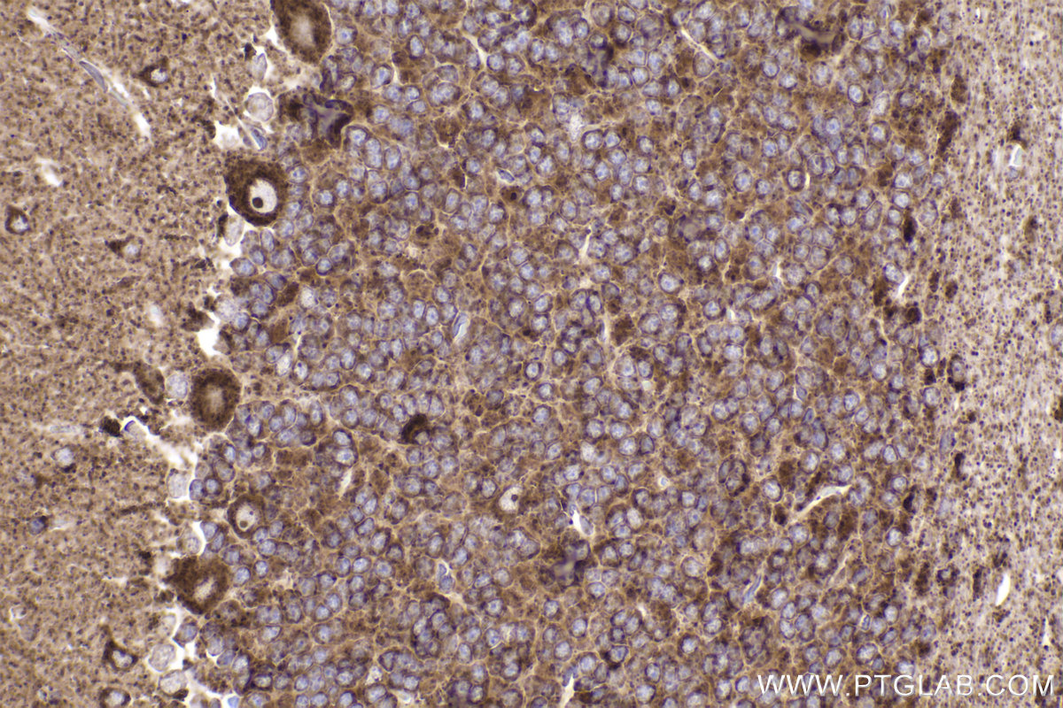 Immunohistochemical analysis of paraffin-embedded rat cerebellum tissue slide using KHC2386 (OGDH IHC Kit).