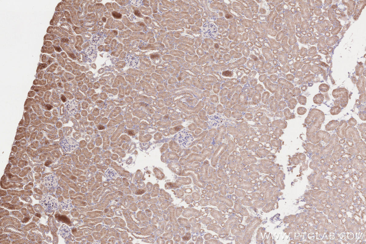 Immunohistochemical analysis of paraffin-embedded mouse kidney tissue slide using KHC2597 (OLFM4 IHC Kit).