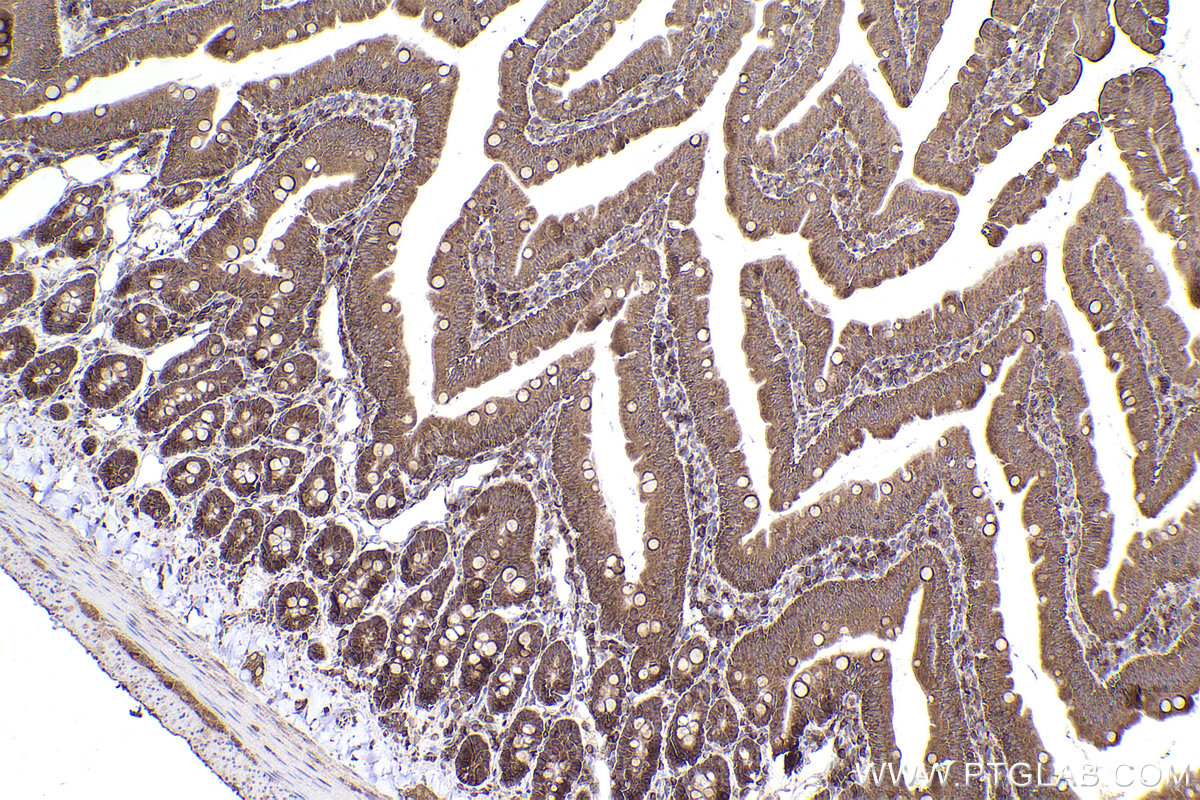 Immunohistochemical analysis of paraffin-embedded rat small intestine tissue slide using KHC2206 (OSBP IHC Kit).