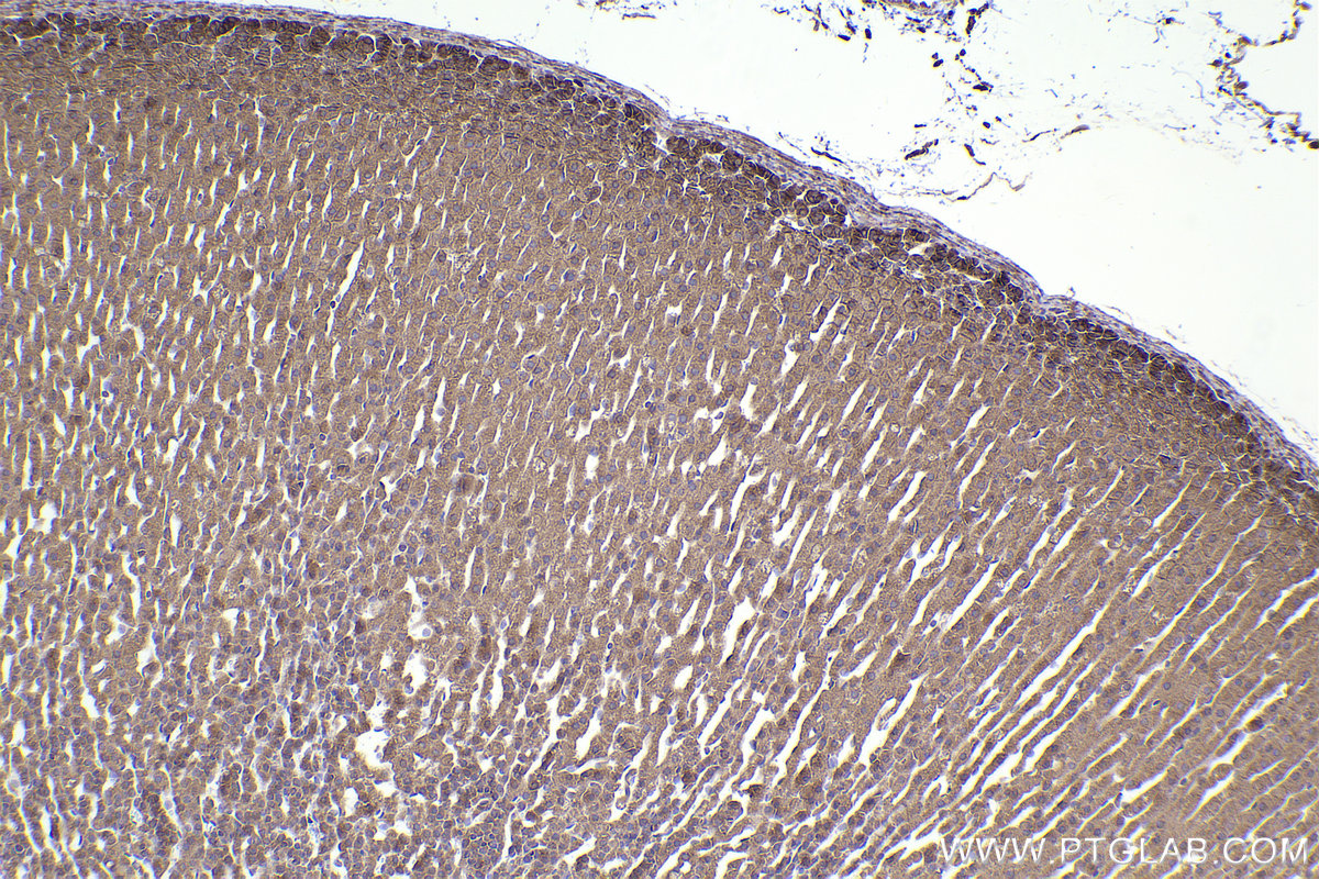 Immunohistochemical analysis of paraffin-embedded rat adrenal gland tissue slide using KHC2206 (OSBP IHC Kit).