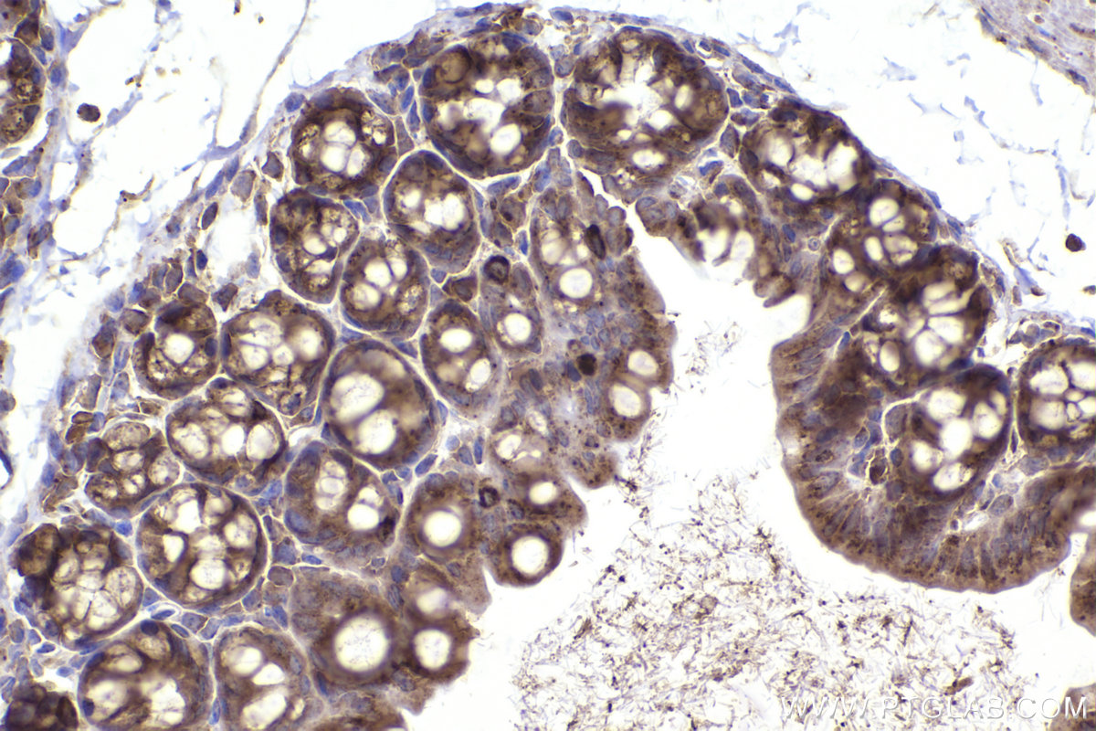 Immunohistochemical analysis of paraffin-embedded mouse small intestine tissue slide using KHC2206 (OSBP IHC Kit).