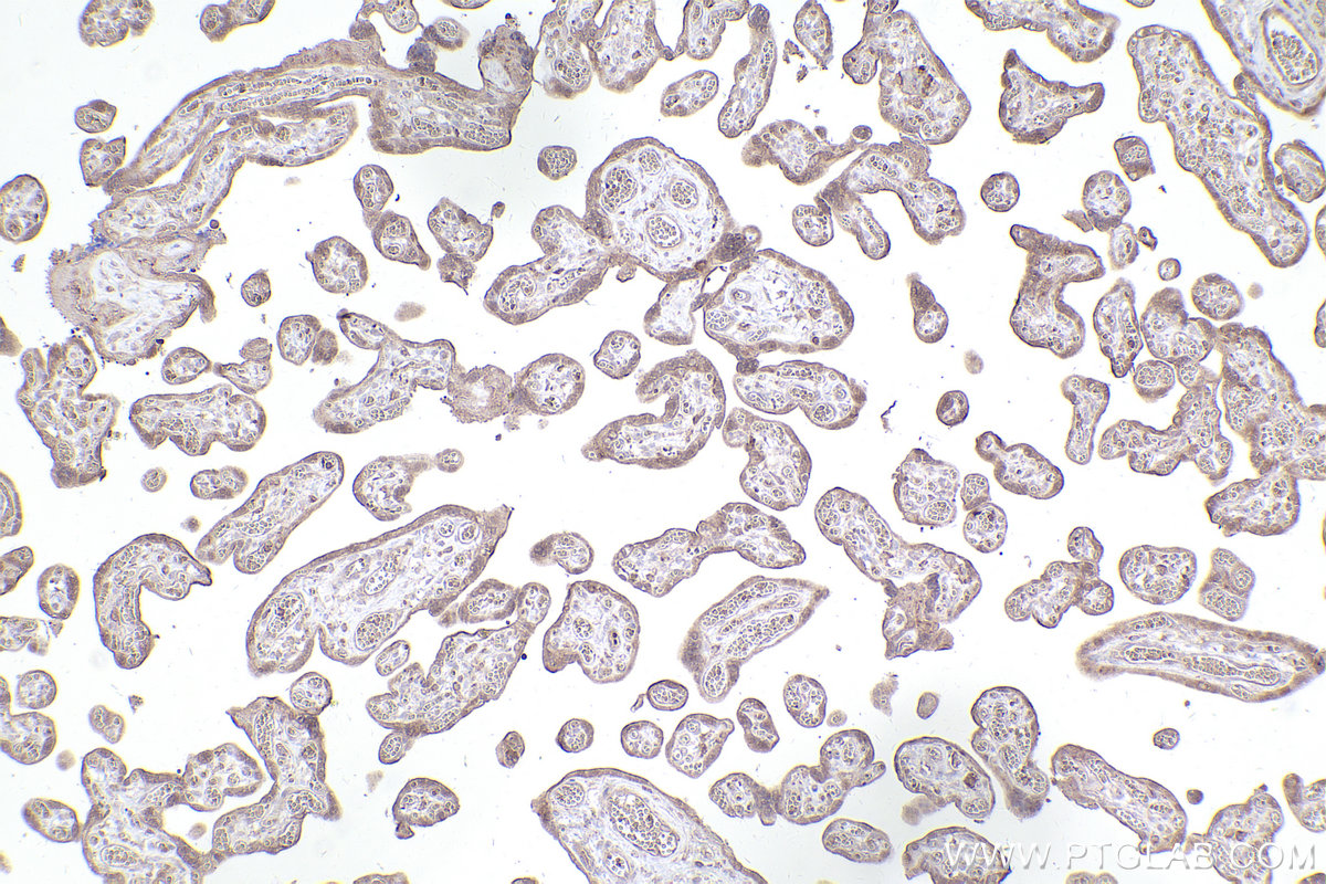 Immunohistochemical analysis of paraffin-embedded human placenta tissue slide using KHC2458 (PAK1 IHC Kit).