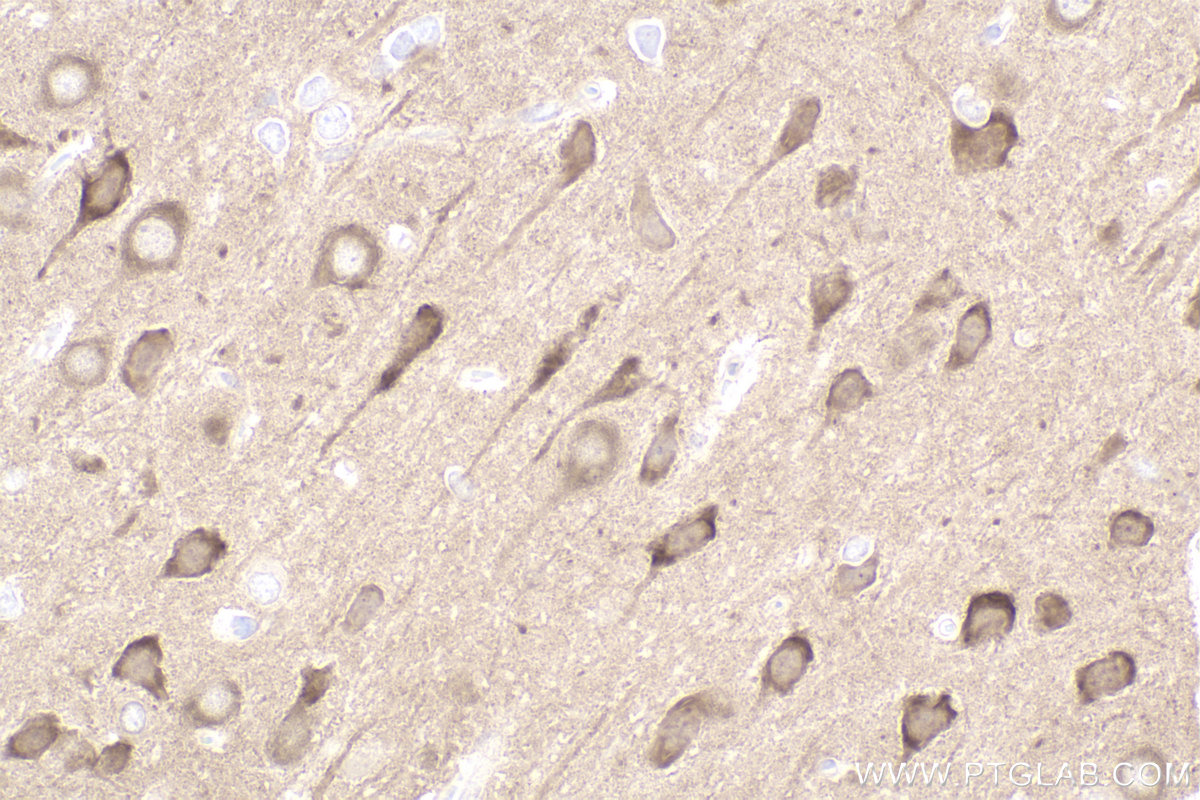 Immunohistochemical analysis of paraffin-embedded rat brain tissue slide using KHC2458 (PAK1 IHC Kit).