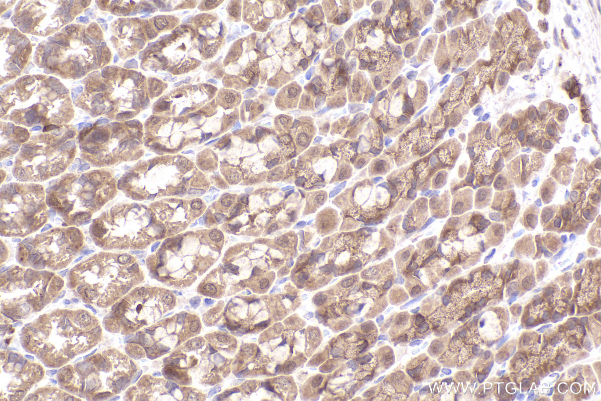 Immunohistochemical analysis of paraffin-embedded rat stomach tissue slide using KHC2458 (PAK1 IHC Kit).